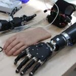 Bionic Limbs