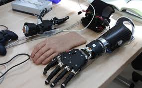 Bionic Limbs