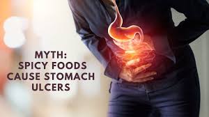 Dispelling the Myth: Spicy Foods and Stomach Ulcers