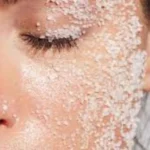 Salt Acne